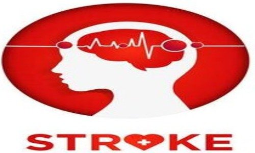 Brain Stroke or Paralysis